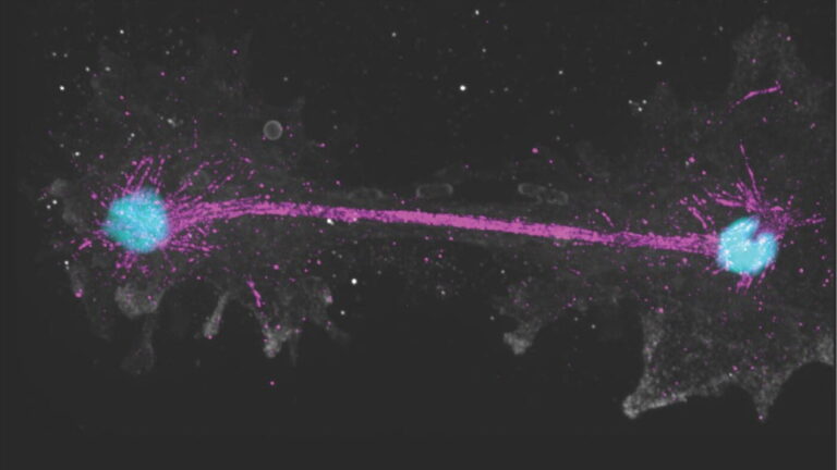 ‘Fire amoeba’ sets new heat tolerance record for complex life